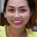 Bích Thảo