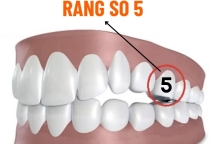 NHA KHOA BẢO TỒN - RĂNG SỐ 5 LÀ RĂNG NÀO? MẤT RĂNG SỐ 5 CÓ SAO KHÔNG?