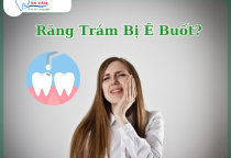 NHA KHOA BẢO TỒN - TRÁM RĂNG XONG BỊ Ê BUỐT DO ĐÂU?