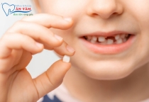 NHA KHOA BẢO TỒN - KHI NÀO NÊN NHỔ RĂNG SỮA CHO TRẺ EM? CÁCH NHỔ AN TOÀN