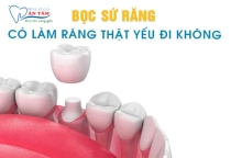NHA KHOA BẢO TỒN - BỌC RĂNG SỨ CÓ LÀM RĂNG THẬT YẾU ĐI KHÔNG?