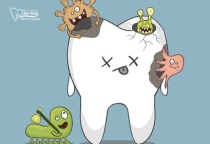 NHA KHOA BẢO TỒN - VI KHUẨN SÂU RĂNG - NHỮNG ĐIỀU CẦN BIẾT ĐỂ BẢO VỆ RĂNG MIỆNG