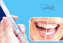 NHA KHOA BẢO TỒN - BÚT TẨY TRẮNG RĂNG LÀ GÌ?