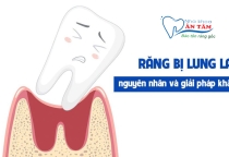 NHA KHOA BẢO TỒN - RĂNG BỊ LUNG LAY DO ĐÂU?