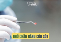 NHA KHOA BẢO TỒN - NHỔ RĂNG CÒN SÓT CHÂN RĂNG DO ĐÂU?