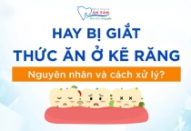 NHA KHOA BẢO TỒN - GIẮT THỨC Ở KẼ RĂNG: NGUYÊN NHÂN VÀ CÁCH KHẮC PHỤC HIỆU QUẢ