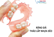 NHA KHOA BẢO TỒN - RĂNG GIẢ THÁO LẮP NHỰA DẺO CÓ TỐT KHÔNG?