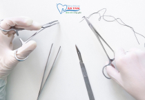 NHA KHOA BẢO TỒN - CHỈ KHÂU TỰ TIÊU LÀ GÌ?