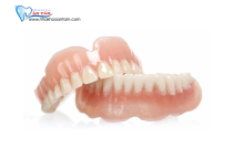PHỤC HÌNH RĂNG THÁO LẮP LÀ GÌ? ƯU NHƯỢC ĐIỂM? PHỤC HÌNH RĂNG THÁO LẮP LÀ GÌ? ƯU NHƯỢC ĐIỂM?