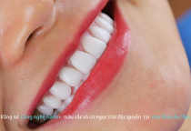 NHA KHOA BẢO TỒN - TRÁM RĂNG SỨ CÓ ĐƯỢC KHÔNG? NHA KHOA BẢO TỒN - TRÁM RĂNG SỨ CÓ ĐƯỢC KHÔNG?