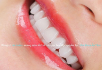 NHA KHOA BẢO TỒN - BỌC RĂNG SỨ BAO LÂU THÌ ĂN ĐƯỢC? NHA KHOA BẢO TỒN - BỌC RĂNG SỨ BAO LÂU THÌ ĂN ĐƯỢC?