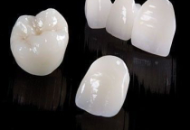 MÃO RĂNG SỨ LÀ GÌ? MÃO RĂNG SỨ LÀ GÌ?