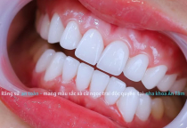 NHA KHOA BẢO TỒN - NƯỚU RĂNG LÀ GÌ: CHỨC NĂNG VÀ CÁCH CHĂM SÓC NƯỚU NHA KHOA BẢO TỒN - NƯỚU RĂNG LÀ GÌ: CHỨC NĂNG VÀ CÁCH CHĂM SÓC NƯỚU