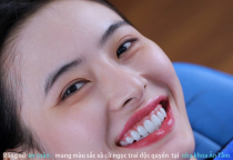 NHA KHOA BẢO TỒN - RĂNG SỨ LAVA CÓ GÌ ĐẶC BIỆT