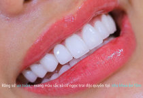 NHA KHOA BẢO TỒN - KHI NÀO CẦN THAY RĂNG SỨ? 