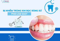 NHA KHOA BẢO TỒN - BỌC RĂNG SỨ BỊ NHIỄM TRÙNG DO ĐÂU? NHA KHOA BẢO TỒN - BỌC RĂNG SỨ BỊ NHIỄM TRÙNG DO ĐÂU?