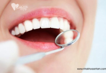 LÀM RĂNG SỨ CẦN CHÚ Ý NHỮNG GÌ? LÀM RĂNG SỨ CẦN CHÚ Ý NHỮNG GÌ?