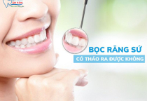 BỌC RĂNG SỨ CÓ THÁO RA ĐƯỢC KHÔNG? BỌC RĂNG SỨ CÓ THÁO RA ĐƯỢC KHÔNG?