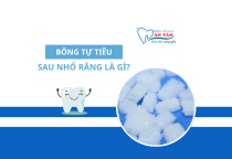 NHA KHOA BẢO TỒN - BÔNG TỰ TIÊU SAU NHỔ RĂNG? NHA KHOA BẢO TỒN - BÔNG TỰ TIÊU SAU NHỔ RĂNG?