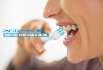 NHA KHOA BẢO TỒN - CÁCH CHĂM SÓC VÀ VỆ SINH RĂNG MIỆNG SAU KHI NHỔ RĂNG KHÔN NHA KHOA BẢO TỒN - CÁCH CHĂM SÓC VÀ VỆ SINH RĂNG MIỆNG SAU KHI NHỔ RĂNG KHÔN