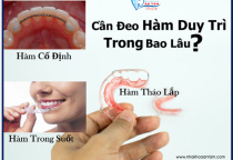 HÀM DUY TRÌ LÀ GÌ? HÀM DUY TRÌ LÀ GÌ?
