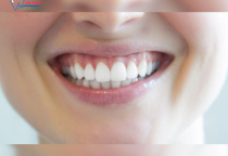 NHA KHOA BẢO TỒN - CẮT LỢI CÓ ĐAU KHÔNG? BAO LÂU THÌ LÀNH NHA KHOA BẢO TỒN - CẮT LỢI CÓ ĐAU KHÔNG? BAO LÂU THÌ LÀNH