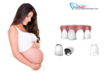 PHỤ NỮ MANG THAI CÓ BỌC RĂNG SỨ ĐƯỢC KHÔNG? PHỤ NỮ MANG THAI CÓ BỌC RĂNG SỨ ĐƯỢC KHÔNG?