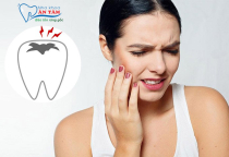 NHA KHOA BẢO TỒN - RĂNG KHÔNG SÂU BỊ ĐAU DO ĐÂU? NHA KHOA BẢO TỒN - RĂNG KHÔNG SÂU BỊ ĐAU DO ĐÂU?