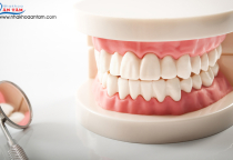 TRỒNG RĂNG GIẢ THÁO LẮP Ở ĐÂU UY TÍN? TRỒNG RĂNG GIẢ THÁO LẮP Ở ĐÂU UY TÍN?