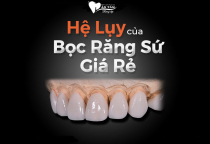 HẬU QUẢ BỌC RĂNG SỨ GIÁ RẺ? HẬU QUẢ BỌC RĂNG SỨ GIÁ RẺ?