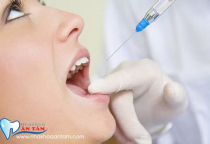 ĐIỀU TRỊ TỦY RĂNG CÓ ĐAU KHÔNG? ĐIỀU TRỊ TỦY RĂNG CÓ ĐAU KHÔNG?