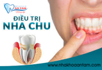 ĐIỀU TRỊ NHA CHU NHƯ THẾ NÀO? ĐIỀU TRỊ NHA CHU NHƯ THẾ NÀO?