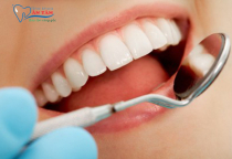 NHA KHOA BẢO TỒN - NÊN KHÁM RĂNG ĐỊNH KỲ BAO LÂU MỘT LẦN? NHA KHOA BẢO TỒN - NÊN KHÁM RĂNG ĐỊNH KỲ BAO LÂU MỘT LẦN?