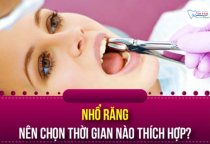 NHA KHOA BẢO TỒN - NÊN NHỔ RĂNG VÀO LÚC NÀO? NHA KHOA BẢO TỒN - NÊN NHỔ RĂNG VÀO LÚC NÀO?