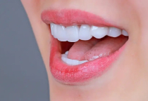 NHA KHOA BẢO TỒN - RĂNG KHỂNH CÓ BỌC SỨ ĐƯỢC KHÔNG? NHA KHOA BẢO TỒN - RĂNG KHỂNH CÓ BỌC SỨ ĐƯỢC KHÔNG?