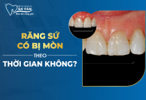 NHA KHOA BẢO TỒN - RĂNG SỨ CÓ BỊ MÒN THEO THỜI GIAN KHÔNG? NHA KHOA BẢO TỒN - RĂNG SỨ CÓ BỊ MÒN THEO THỜI GIAN KHÔNG?