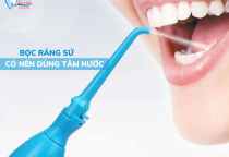 SAU KHI BỌC RĂNG SỨ CÓ NÊN DÙNG MÁY TĂM NƯỚC KHÔNG? SAU KHI BỌC RĂNG SỨ CÓ NÊN DÙNG MÁY TĂM NƯỚC KHÔNG?