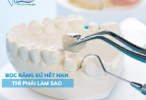 DẤU HIỆU NHẬN BIẾT RĂNG SỨ HẾT HẠN? DẤU HIỆU NHẬN BIẾT RĂNG SỨ HẾT HẠN?