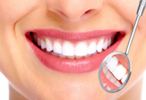 NHA KHOA BẢO TỒN - BỌC RĂNG SỨ CÓ BỀN KHÔNG VÀ DUY TRÌ ĐƯỢC BAO LÂU ?  NHA KHOA BẢO TỒN - BỌC RĂNG SỨ CÓ BỀN KHÔNG VÀ DUY TRÌ ĐƯỢC BAO LÂU ?