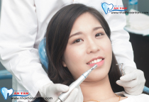 BỌC RĂNG SỨ BỊ CỘM NGUYÊN NHÂN DO ĐÂU? BỌC RĂNG SỨ BỊ CỘM NGUYÊN NHÂN DO ĐÂU?