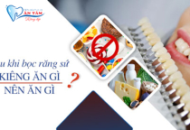 SAU KHI BỌC RĂNG SỨ NÊN KIÊNG GÌ? SAU KHI BỌC RĂNG SỨ NÊN KIÊNG GÌ?