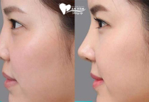 MEWING LÀ GÌ VÀ THỰC HIỆN NHƯ THẾ NÀO HIỆU QUẢ? MEWING LÀ GÌ VÀ THỰC HIỆN NHƯ THẾ NÀO HIỆU QUẢ?