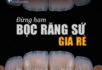 HẬU QUẢ KHÔN LƯỜNG KHI BỌC RĂNG SỨ GIÁ RẺ? HẬU QUẢ KHÔN LƯỜNG KHI BỌC RĂNG SỨ GIÁ RẺ?