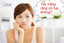 NHA KHOA BẢO TỒN - TẨY TRẮNG RĂNG CÓ HẠI KHÔNG? NHA KHOA BẢO TỒN - TẨY TRẮNG RĂNG CÓ HẠI KHÔNG?