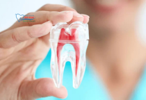 NHA KHOA BẢO TỒN - ĐIỀU TRỊ TỦY RĂNG BAO LÂU SẼ LÀNH? NHA KHOA BẢO TỒN - ĐIỀU TRỊ TỦY RĂNG BAO LÂU SẼ LÀNH?
