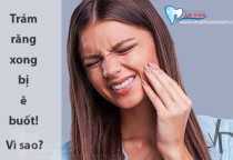 SAU KHI TRÁM RĂNG BỊ Ê BUỐT PHẢI LÀM SAO? SAU KHI TRÁM RĂNG BỊ Ê BUỐT PHẢI LÀM SAO?