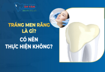 TRÁNG MEN RĂNG LÀ GÌ? TRÁNG MEN RĂNG LÀ GÌ?