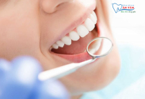NHỮNG YẾU TỐ ẢNH HƯỞNG ĐẾN CHI PHÍ TRỒNG RĂNG SỨ NHỮNG YẾU TỐ ẢNH HƯỞNG ĐẾN CHI PHÍ TRỒNG RĂNG SỨ