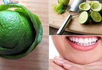 NGUYÊN NHÂN BỊ ĐEN Ở CHÂN RĂNG VÀ CÁCH ĐIỀU TRỊ NGUYÊN NHÂN BỊ ĐEN Ở CHÂN RĂNG VÀ CÁCH ĐIỀU TRỊ