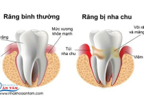 CẤU TẠO RĂNG CỦA NGƯỜI CẤU TẠO RĂNG CỦA NGƯỜI
